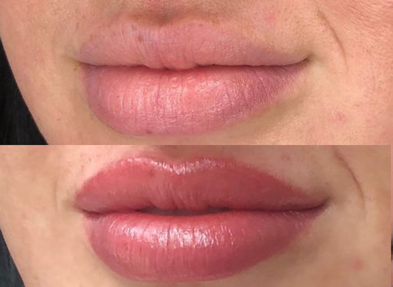 pum-lips